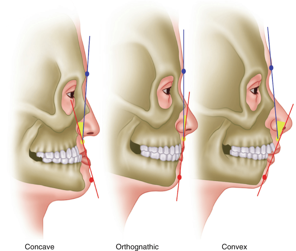 Creating Aesthetic Smile / Orthognathic Surgery / Jaw Correction Surgery Creating Aesthetic Smile / Orthognathic Surgery / Jaw Correction Surgery