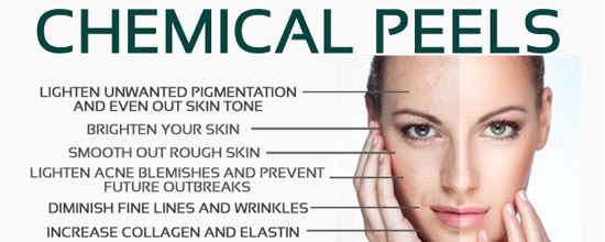 Chemical Peeling Chemical Peeling
