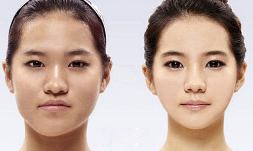 Getting Cute Face / Converting Square Face into Long Face Getting Cute Face / Converting Square Face into Long Face