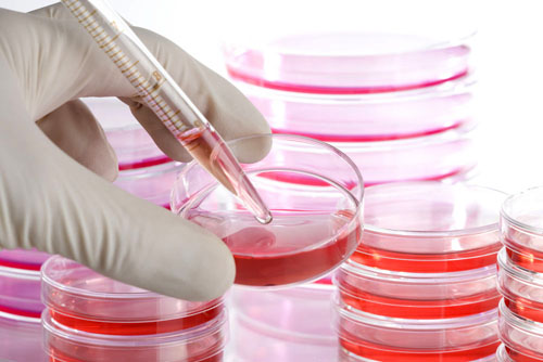 Stem Cell Therapy Stem Cell Therapy
